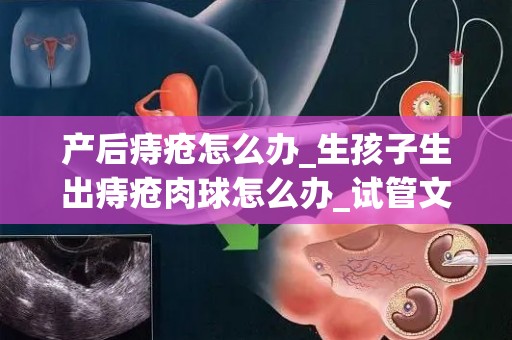 产后痔疮怎么办_生孩子生出痔疮肉球怎么办_试管文章