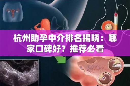 杭州助孕中介排名揭晓：哪家口碑好？推荐必看
