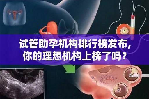 试管助孕机构排行榜发布,你的理想机构上榜了吗？