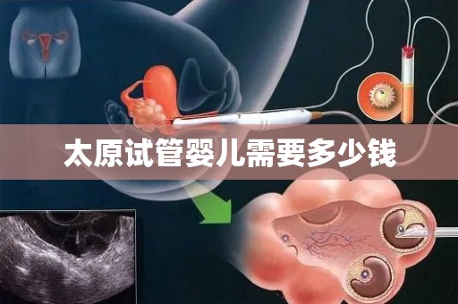 太原试管婴儿需要多少钱