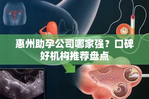 惠州助孕公司哪家强？口碑好机构推荐盘点