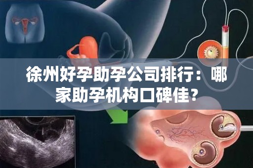 徐州好孕助孕公司排行：哪家助孕机构口碑佳？