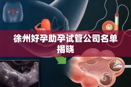 徐州好孕助孕试管公司名单揭晓