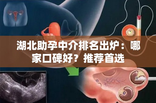 湖北助孕中介排名出炉：哪家口碑好？推荐首选