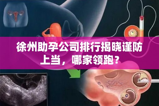 徐州助孕公司排行揭晓谨防上当，哪家领跑？