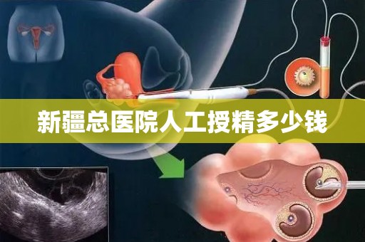 新疆总医院人工授精多少钱