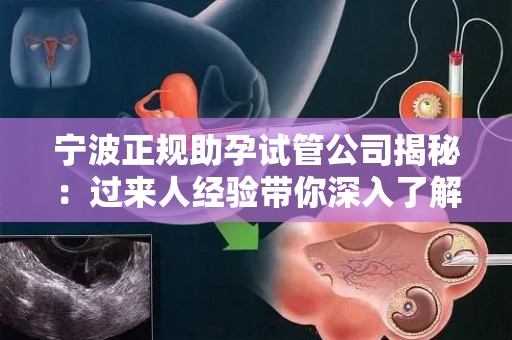 宁波正规助孕试管公司揭秘：过来人经验带你深入了解
