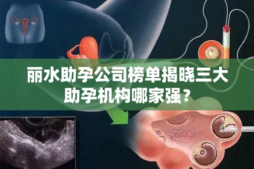 丽水助孕公司榜单揭晓三大助孕机构哪家强？
