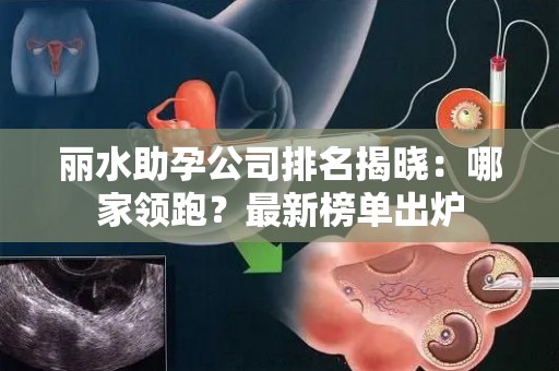 丽水助孕公司排名揭晓：哪家领跑？最新榜单出炉