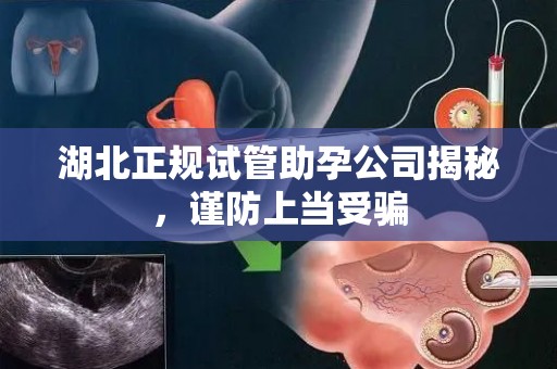 湖北正规试管助孕公司揭秘，谨防上当受骗