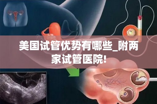 美国试管优势有哪些_附两家试管医院!