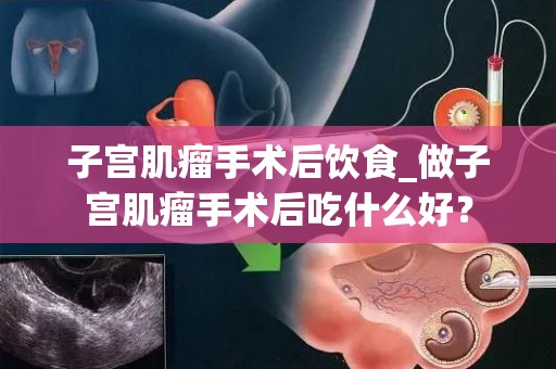 子宫肌瘤手术后饮食_做子宫肌瘤手术后吃什么好？